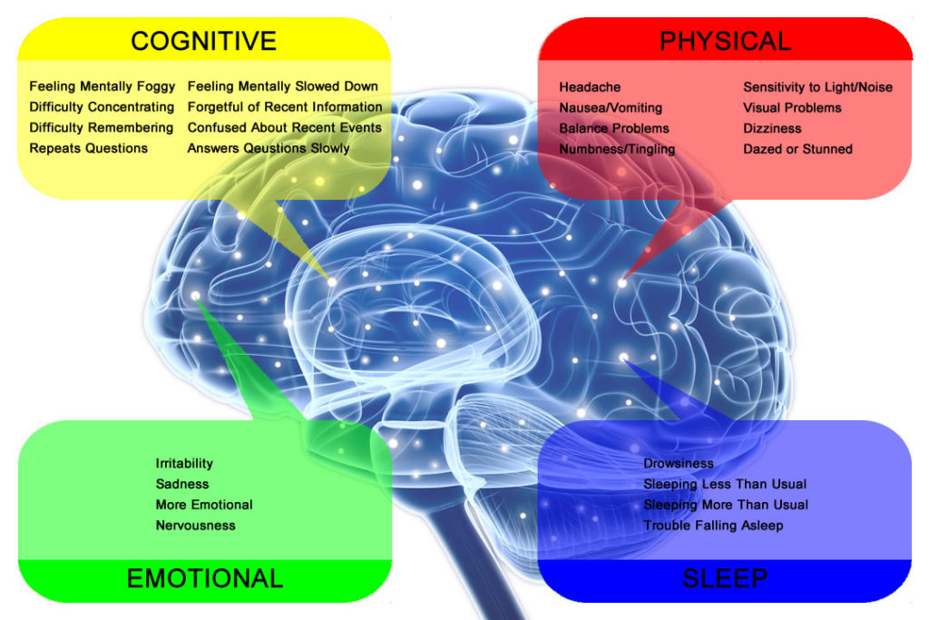 Concussion Symptoms